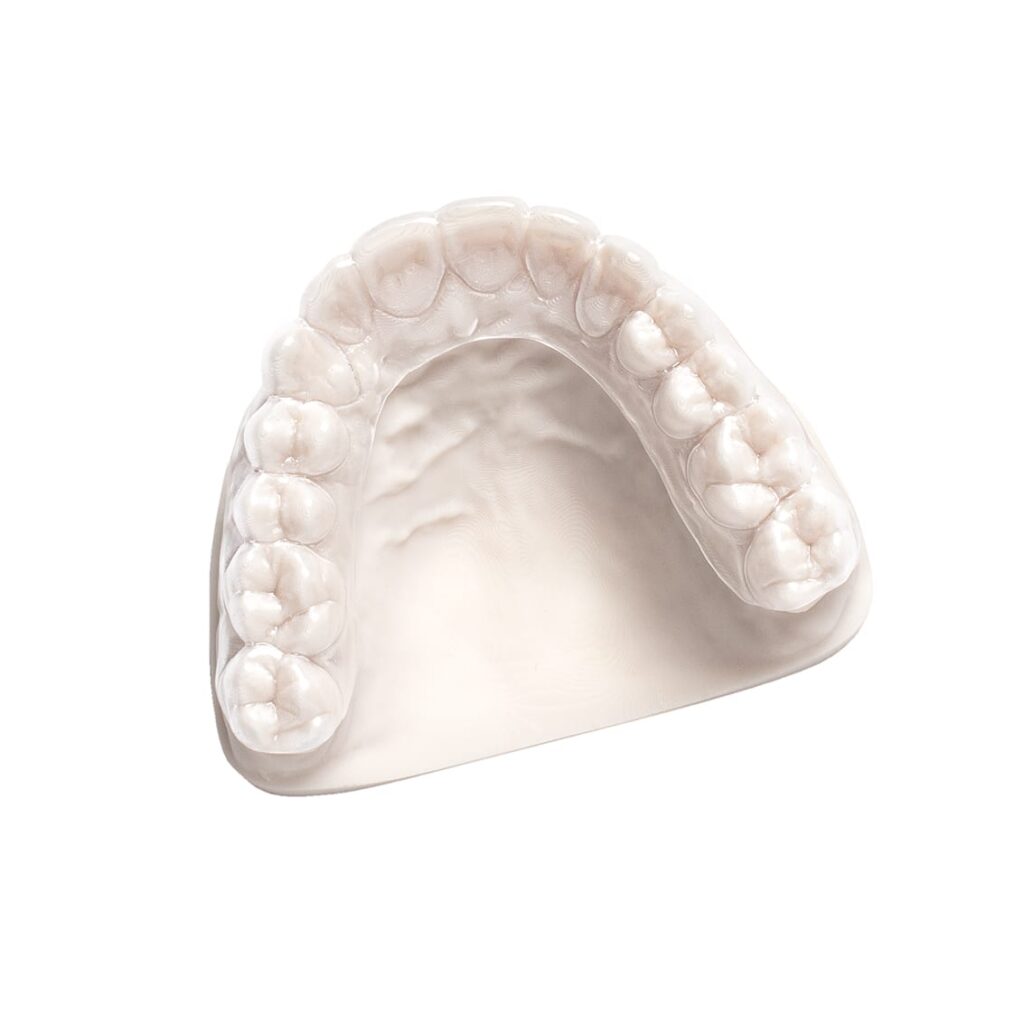 Dental aligner mass customization